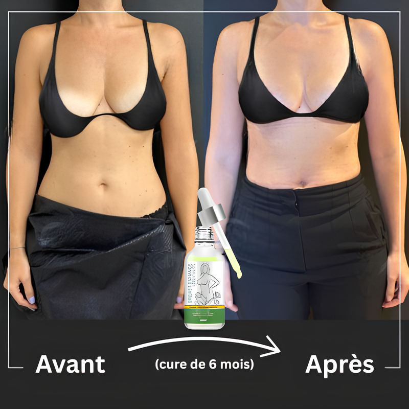 Sérum Rehausse-Poitrine ShapeTouch